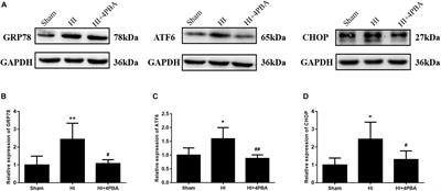 Sodium 4-Phenylbutyrate Protects Hypoxic-Ischemic Brain Injury via Attenuating Endoplasmic Reticulum Stress in Neonatal Rats